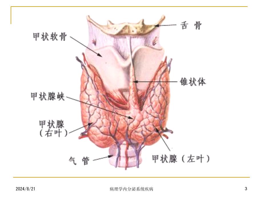 病理学内分泌系统疾病课件_第3页