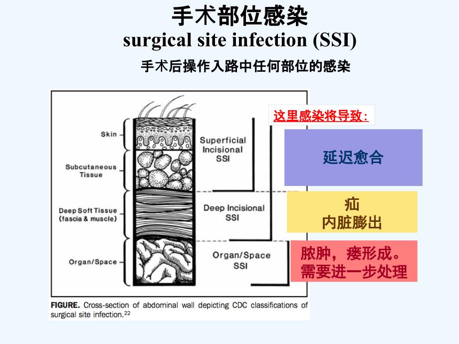 预防性抗菌素与外科部位感染控制8课件_第2页