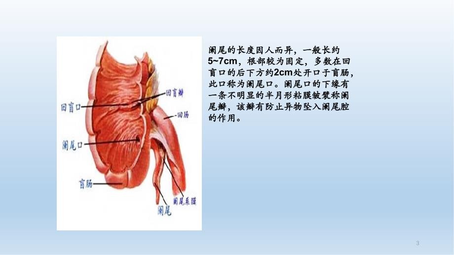 阑尾炎解剖特点干货分享_第3页