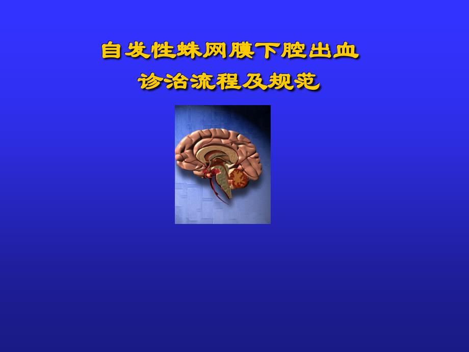 自发性蛛网膜下腔出血诊治流程及规范_第1页