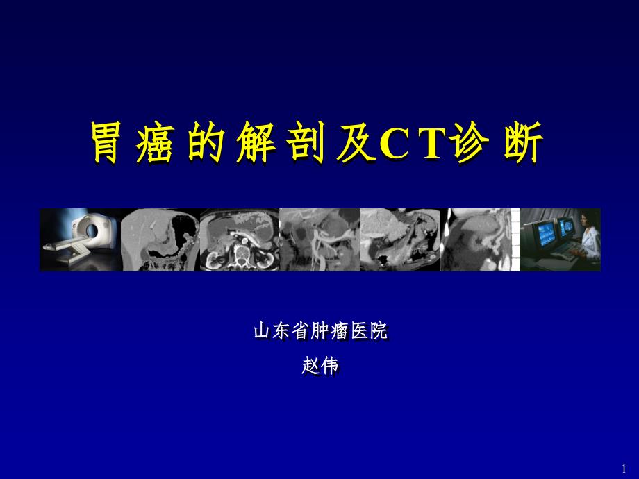 胃癌的解剖及CT诊断(课堂PPT)_第1页