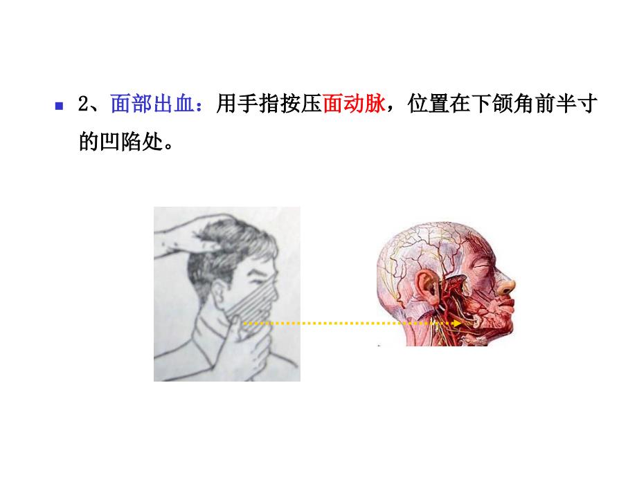 创伤现场急救四项基本技术_第4页