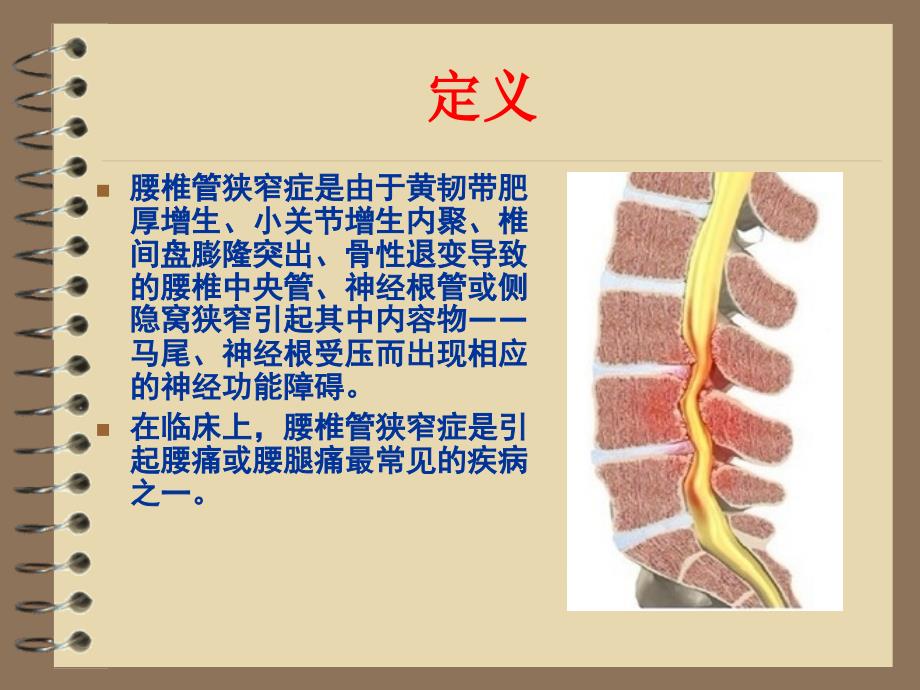 《中西医结合骨伤科学》教学课件：腰椎管狭窄_第3页