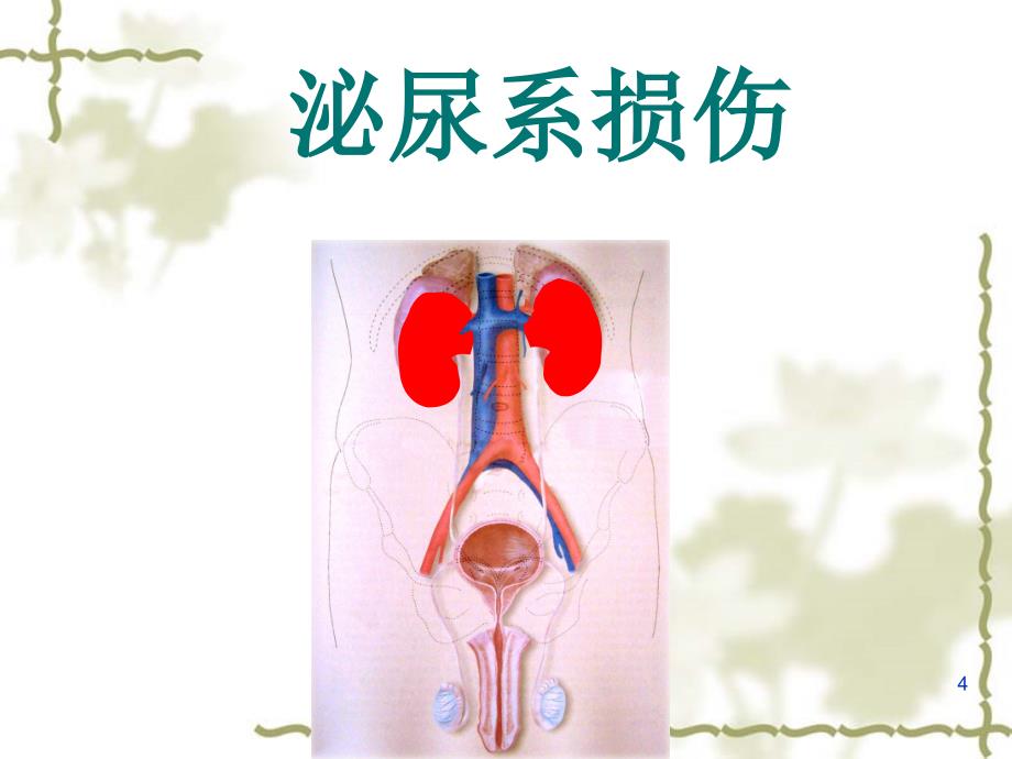 泌尿系损伤病人的护理ppt课件_第4页