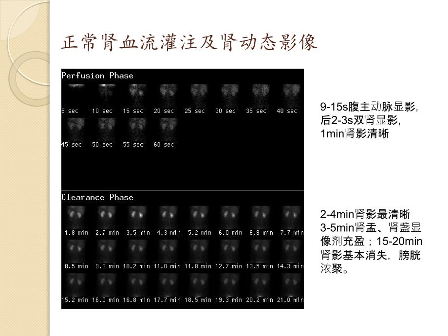 影像诊断学课件：泌尿系统核医学显像 2016 预防_第4页