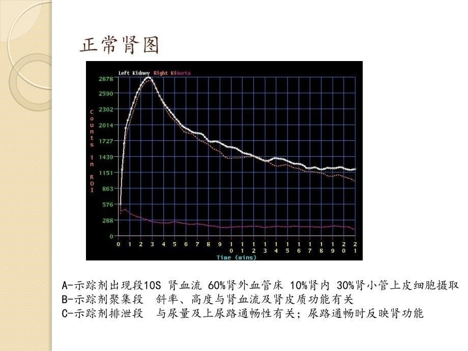 影像诊断学课件：泌尿系统核医学显像 2016 预防_第5页