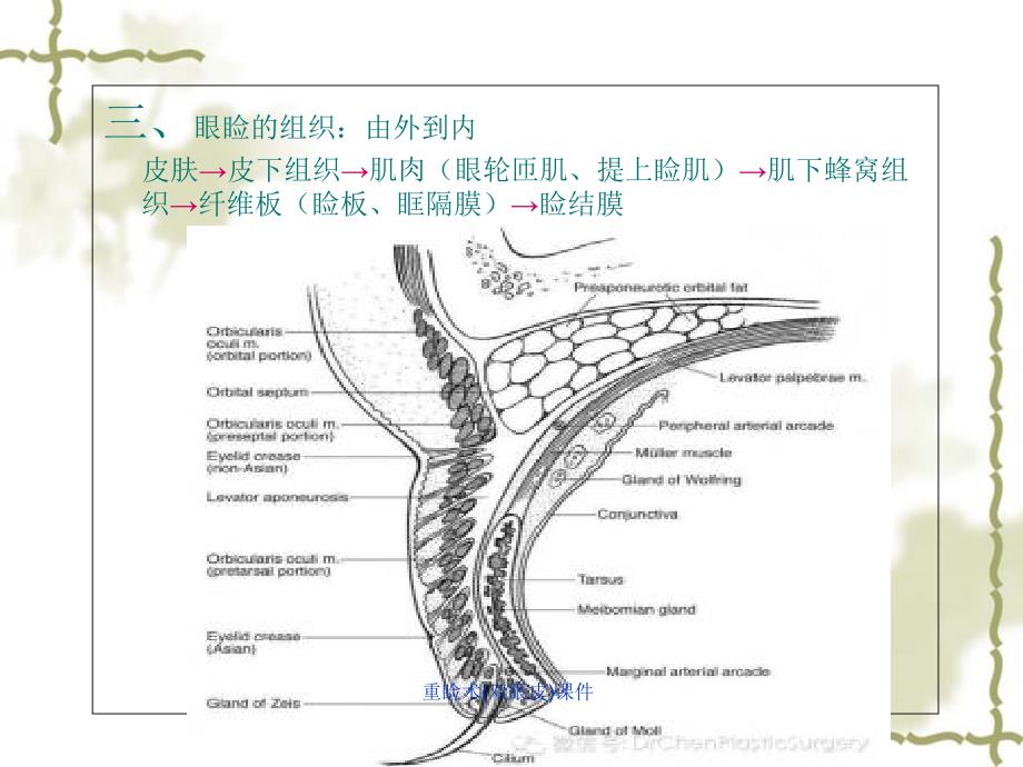 重睑术(双眼皮)课件_第3页