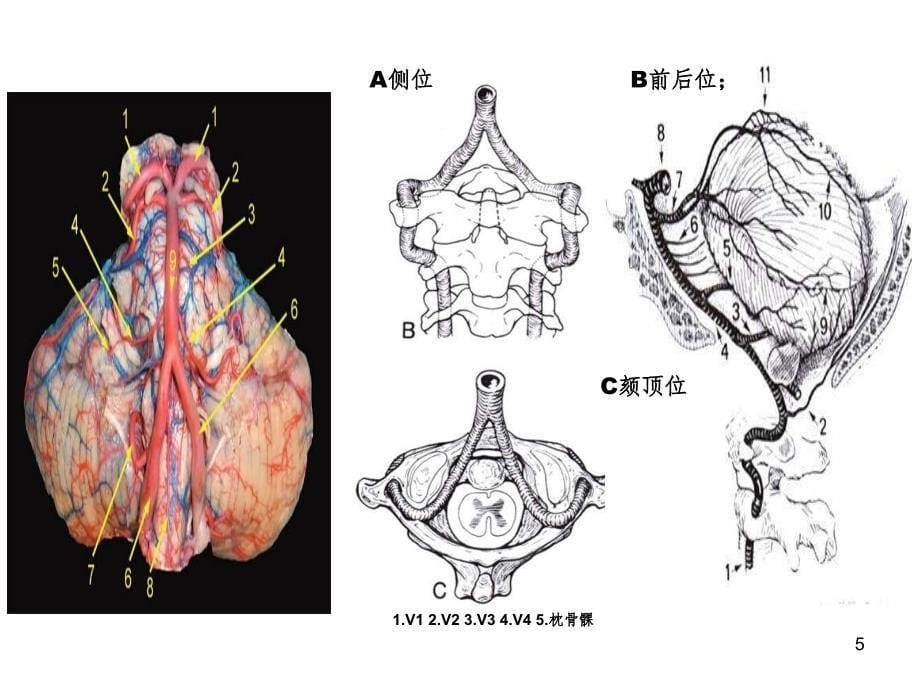 脑部血管解剖图解影像学PPT演示课件_第5页