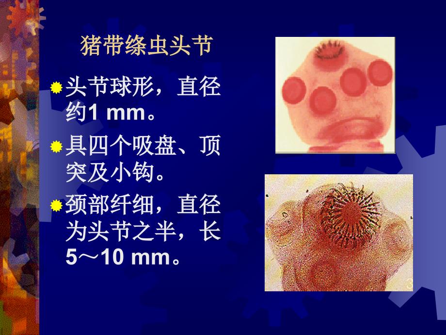 链状带绦虫猪带绦虫病囊尾蚴病PPT课件_第4页