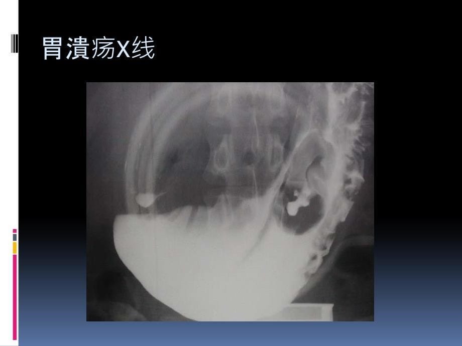 上消化道大出血的鉴别诊断及处理原则文档资料_第5页