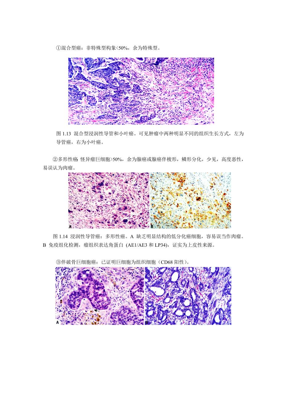 WHO乳腺肿瘤组织学分类9月1日_第2页