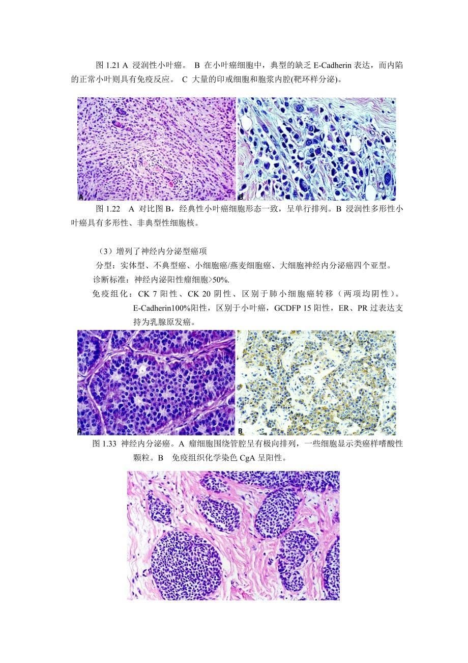 WHO乳腺肿瘤组织学分类9月1日_第5页