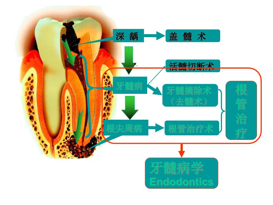 根管治疗的步骤方法器械4课件_第2页