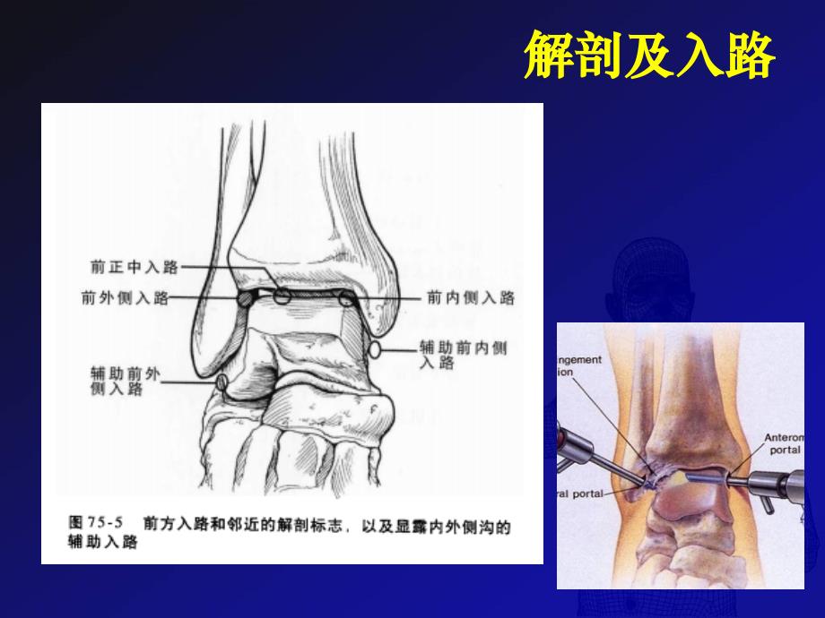 踝关节镜技术PPT课件_第3页