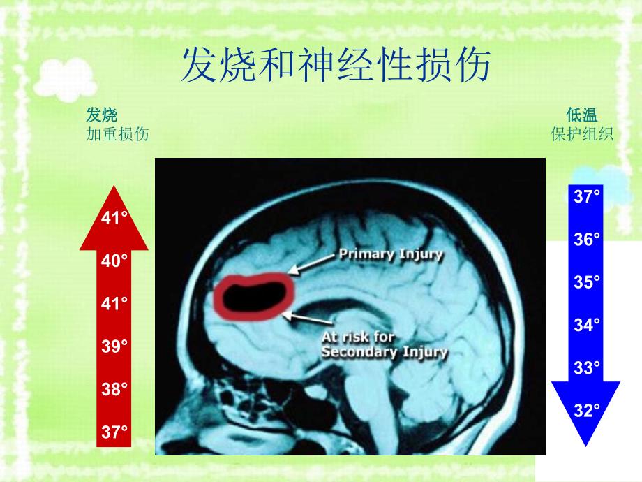 《亚低温治疗》课件_第3页