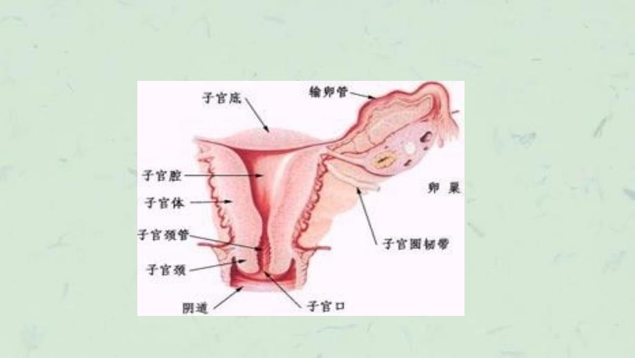 卵巢癌的护理 (2)课件_第3页