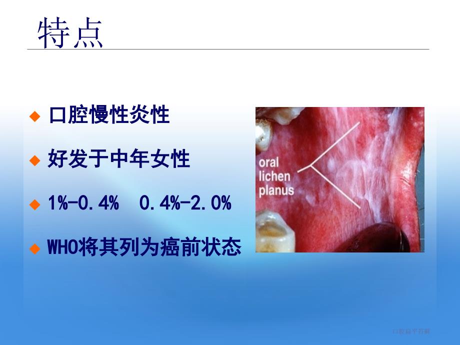 最新口腔扁平苔藓_第2页