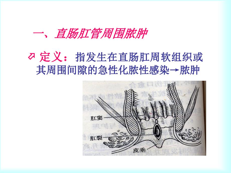 第二十四章大肠肛管疾病护理_第3页