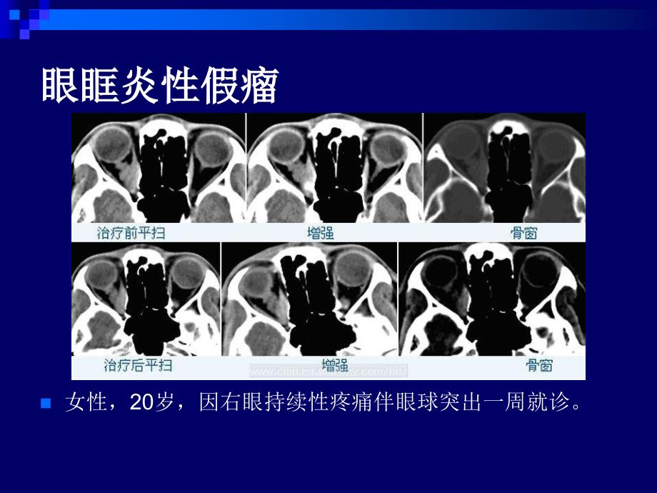 官和颈部典型病例影像读_第2页