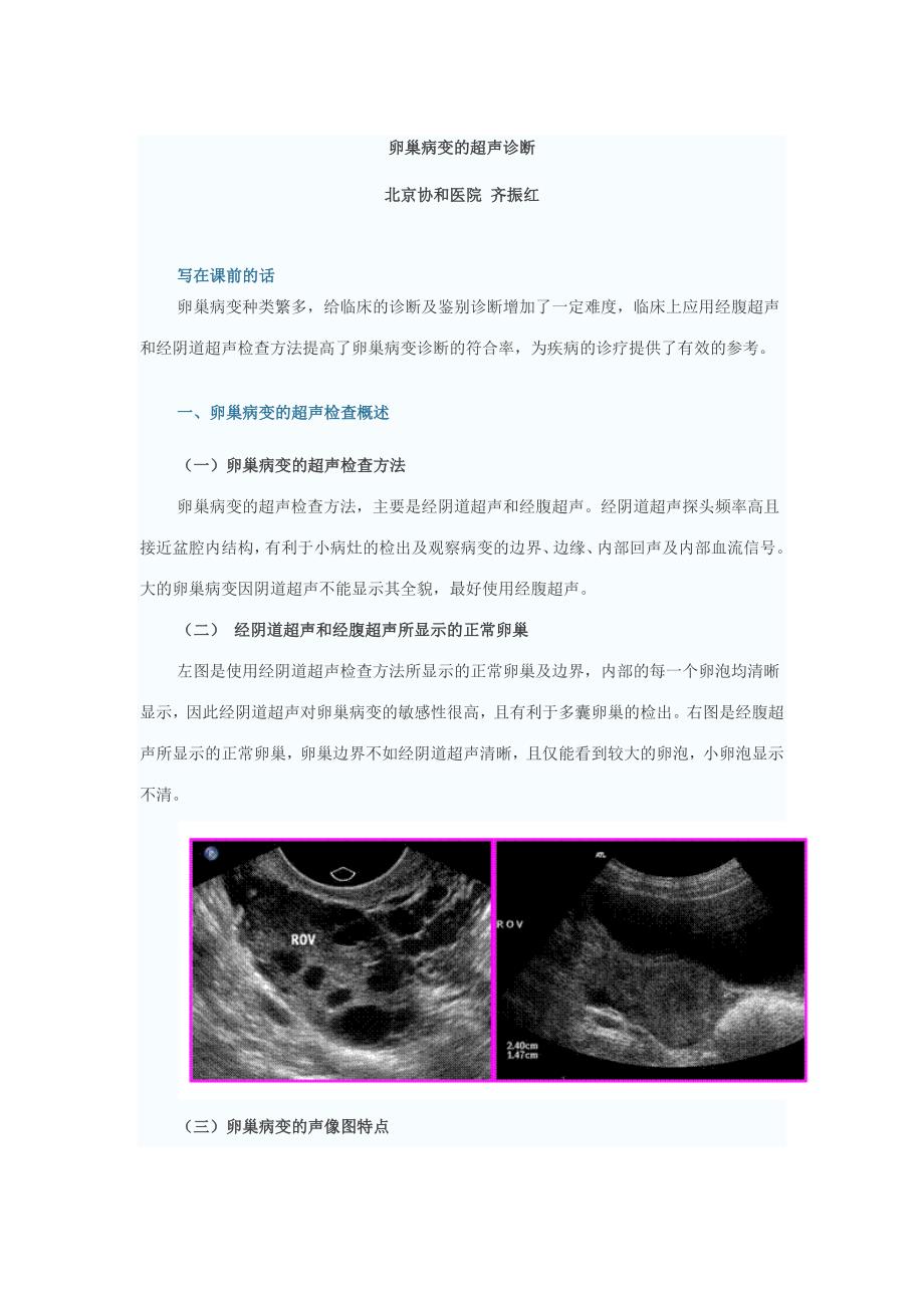 卵巢病变的超声诊断.doc_第1页