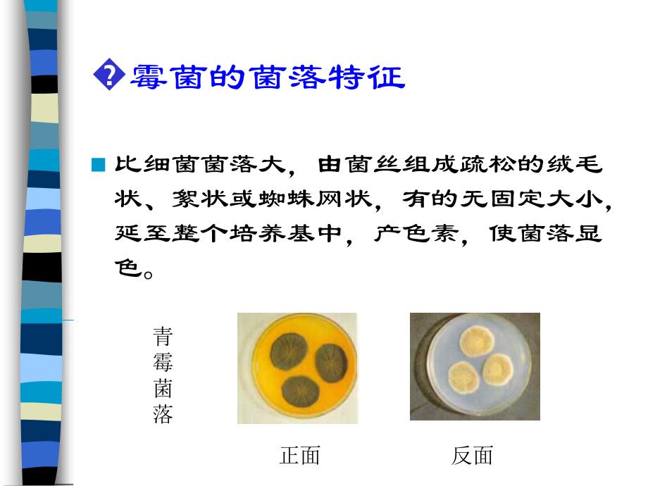 实验9霉菌形态及其菌落特征的观察_第3页