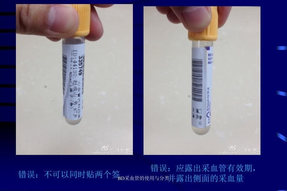 BD采血管的使用与分类课件_第5页