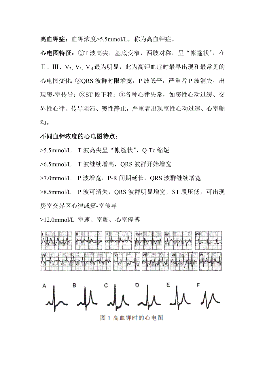 11月高血钾的心电图表现_第1页