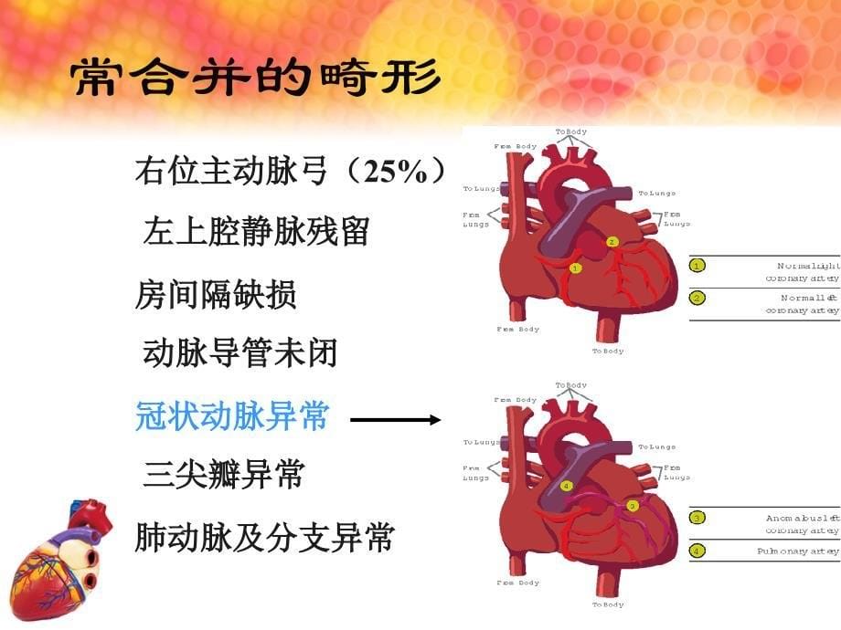 心脏彩超在法四术前及术后评价中的重要价值课件_第5页