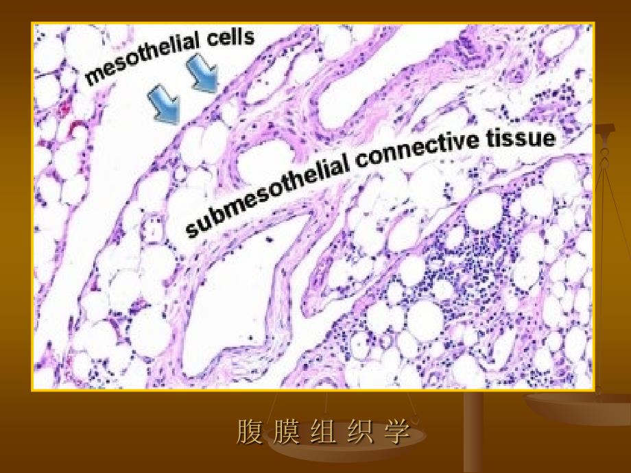 腹膜肠系膜解剖及常见肿瘤教学文案_第4页