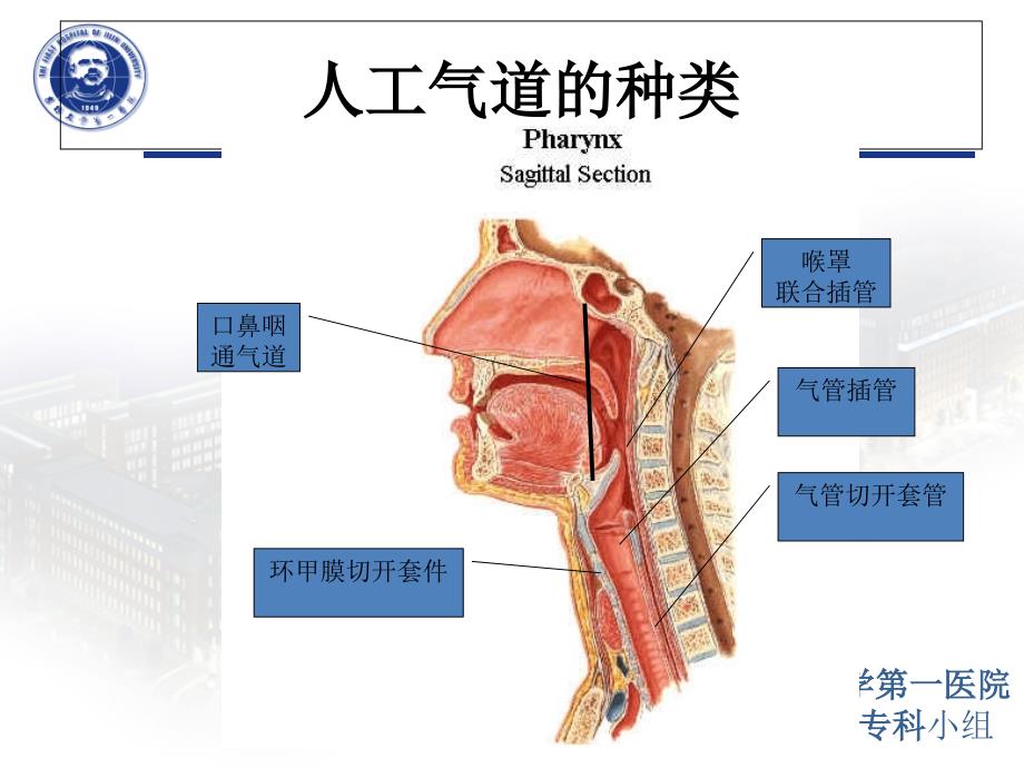 气道位置与气囊管理.ppt_第4页