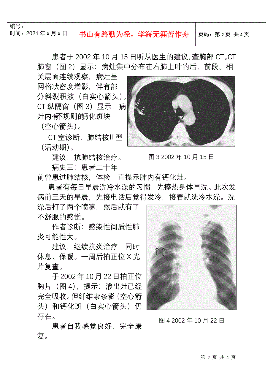 肺部病变放射诊断误诊分析doc-肺部病变放射诊断误诊一例_第2页
