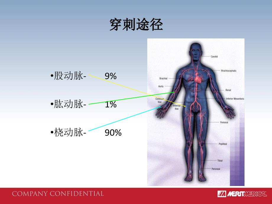 医疗IC产品培训：1.Advance穿刺针_第4页