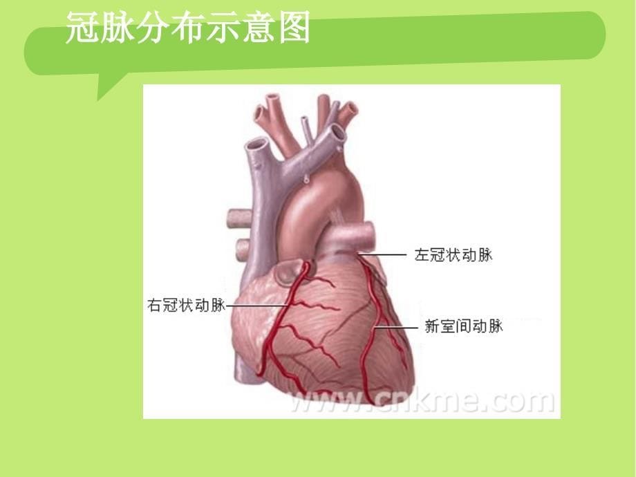 IABP护理查房_第5页