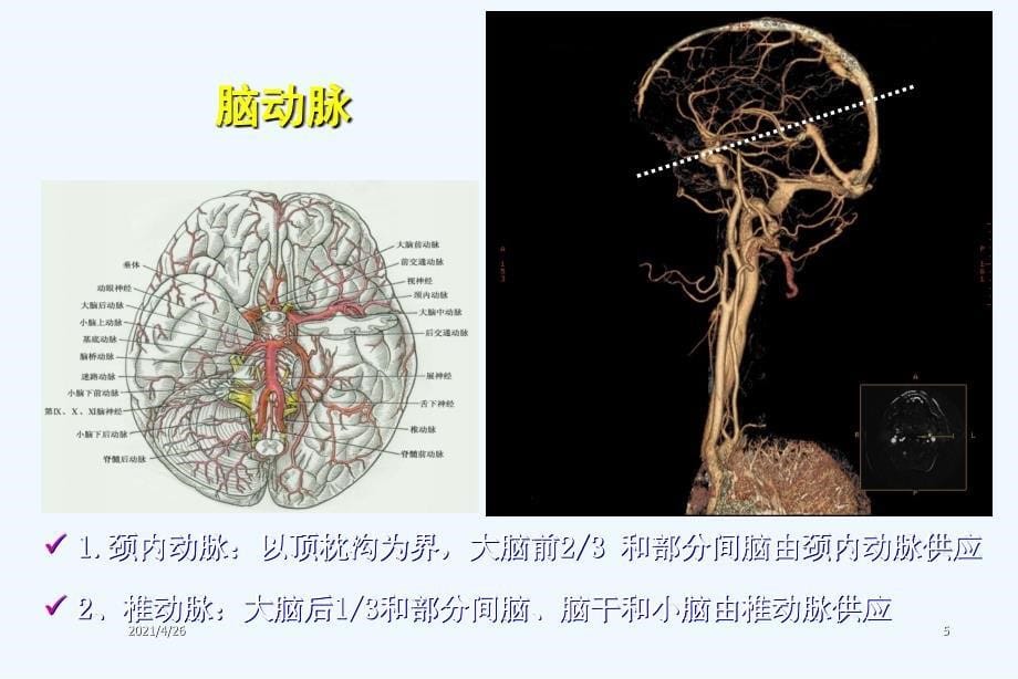 脑血管供应区域与脑梗死影像表现（72页）_第5页