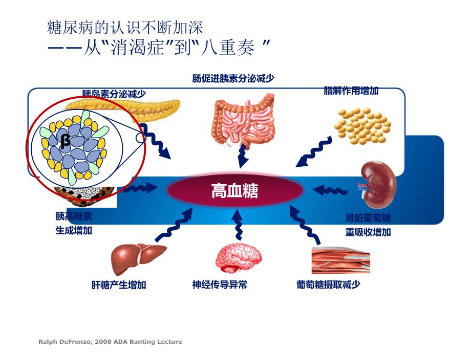 糖尿病药物治疗概述课件.ppt_第4页