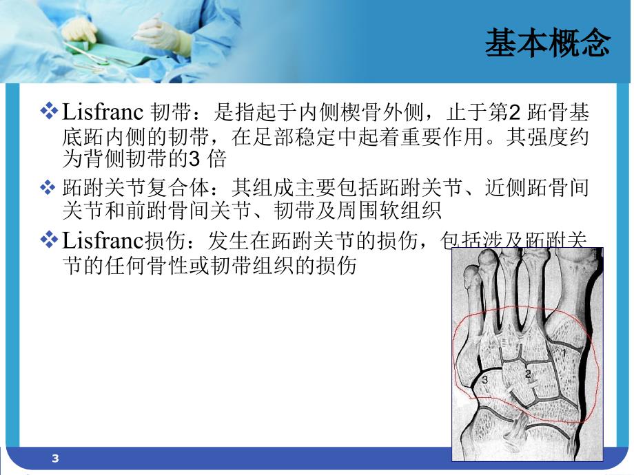 Lisfranc 损伤（行业荟萃）_第3页