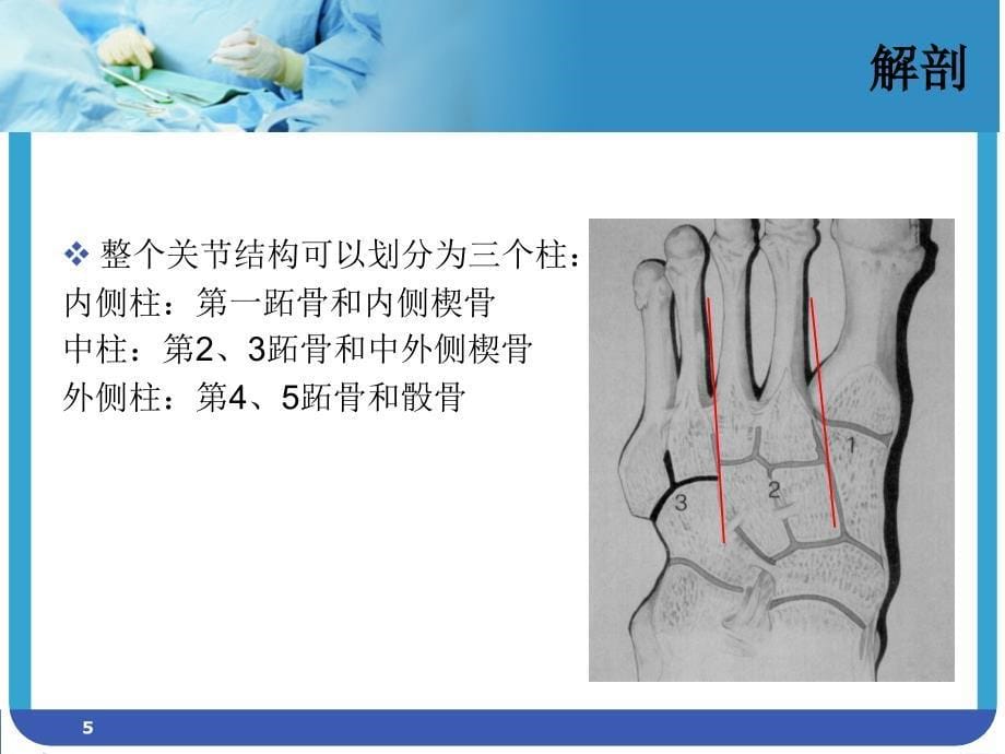 Lisfranc 损伤（行业荟萃）_第5页