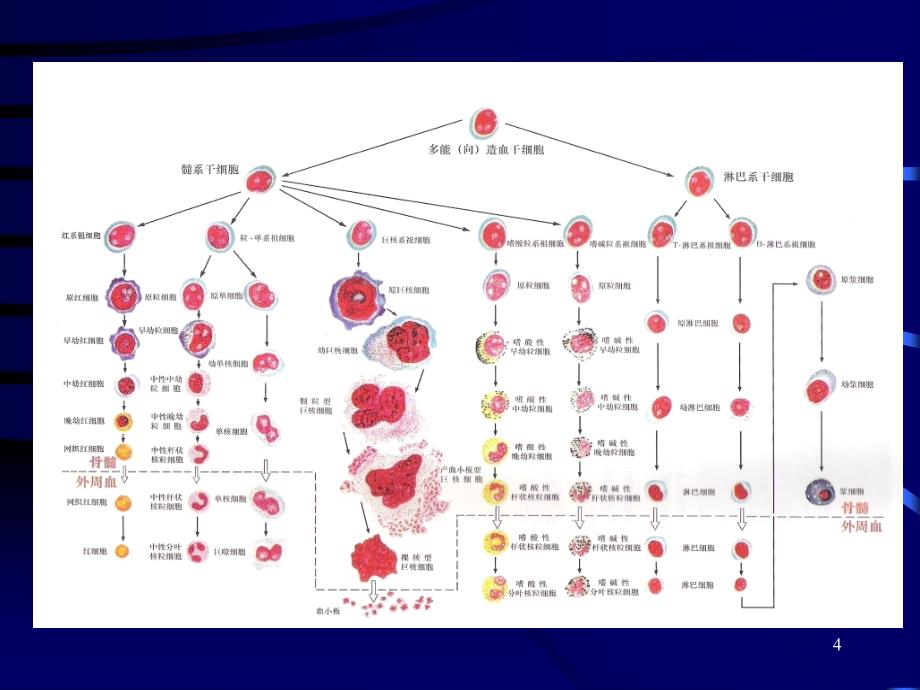 内科学教学课件：34 白血病_第4页