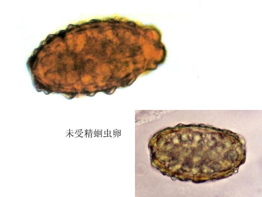 寄生虫实验图课件_第2页