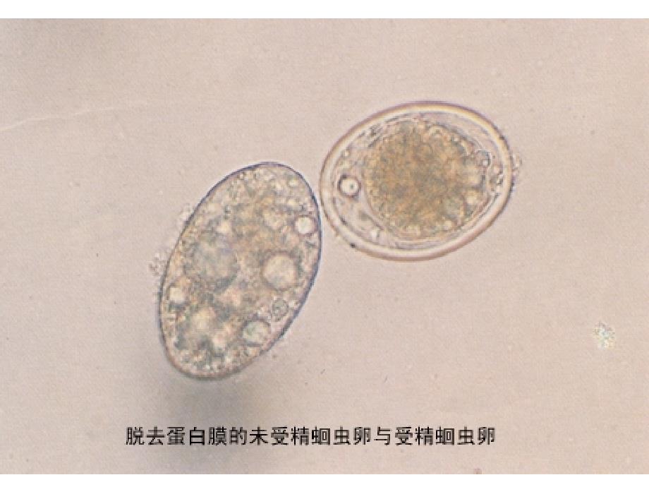 寄生虫实验图课件_第3页