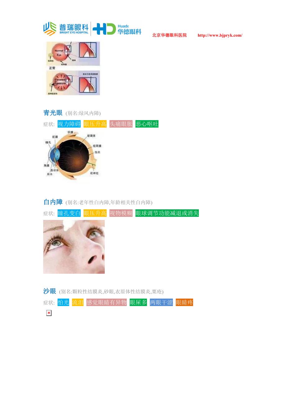 41条常见眼病症状知识大全快来收藏吧_第2页