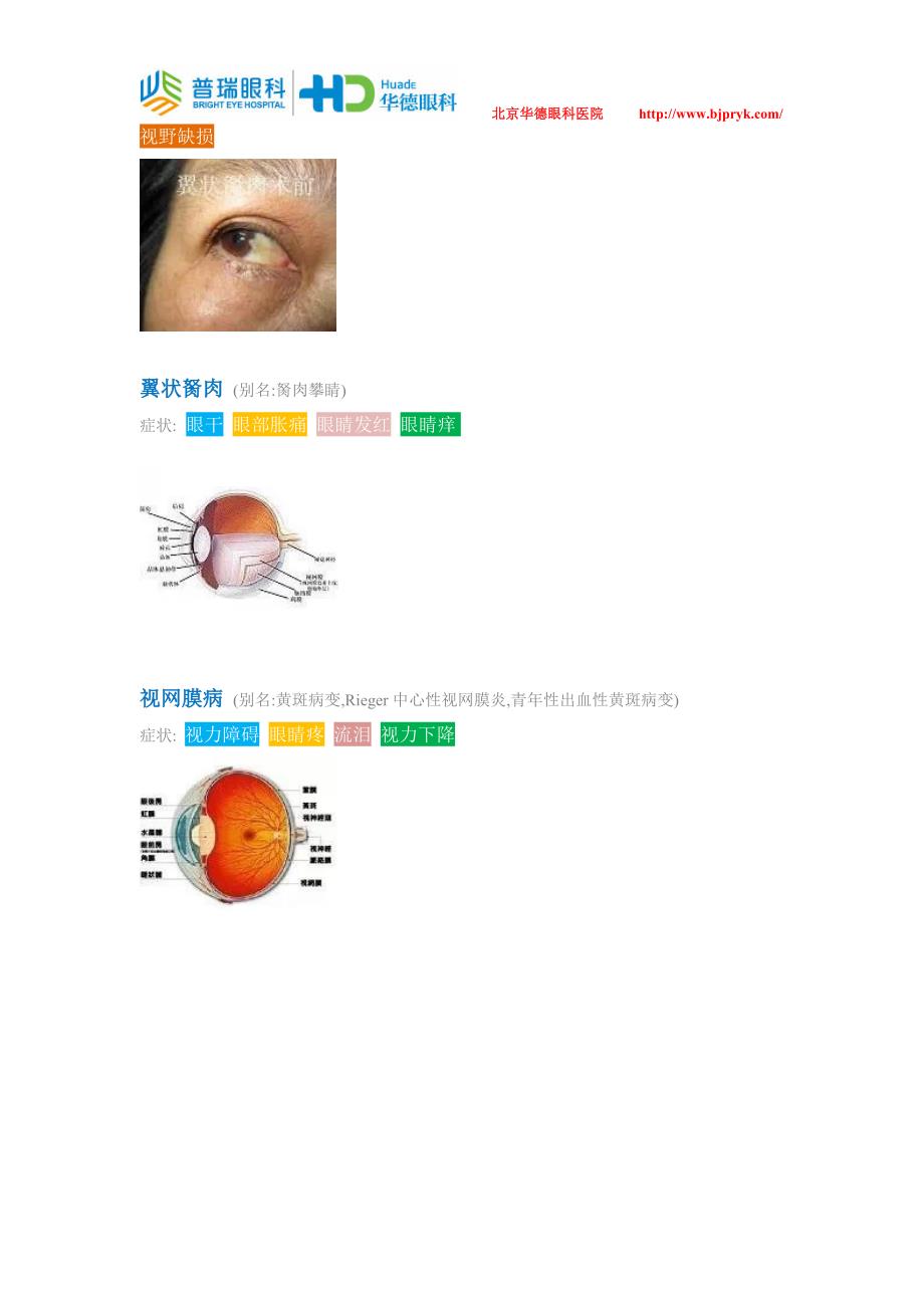 41条常见眼病症状知识大全快来收藏吧_第4页