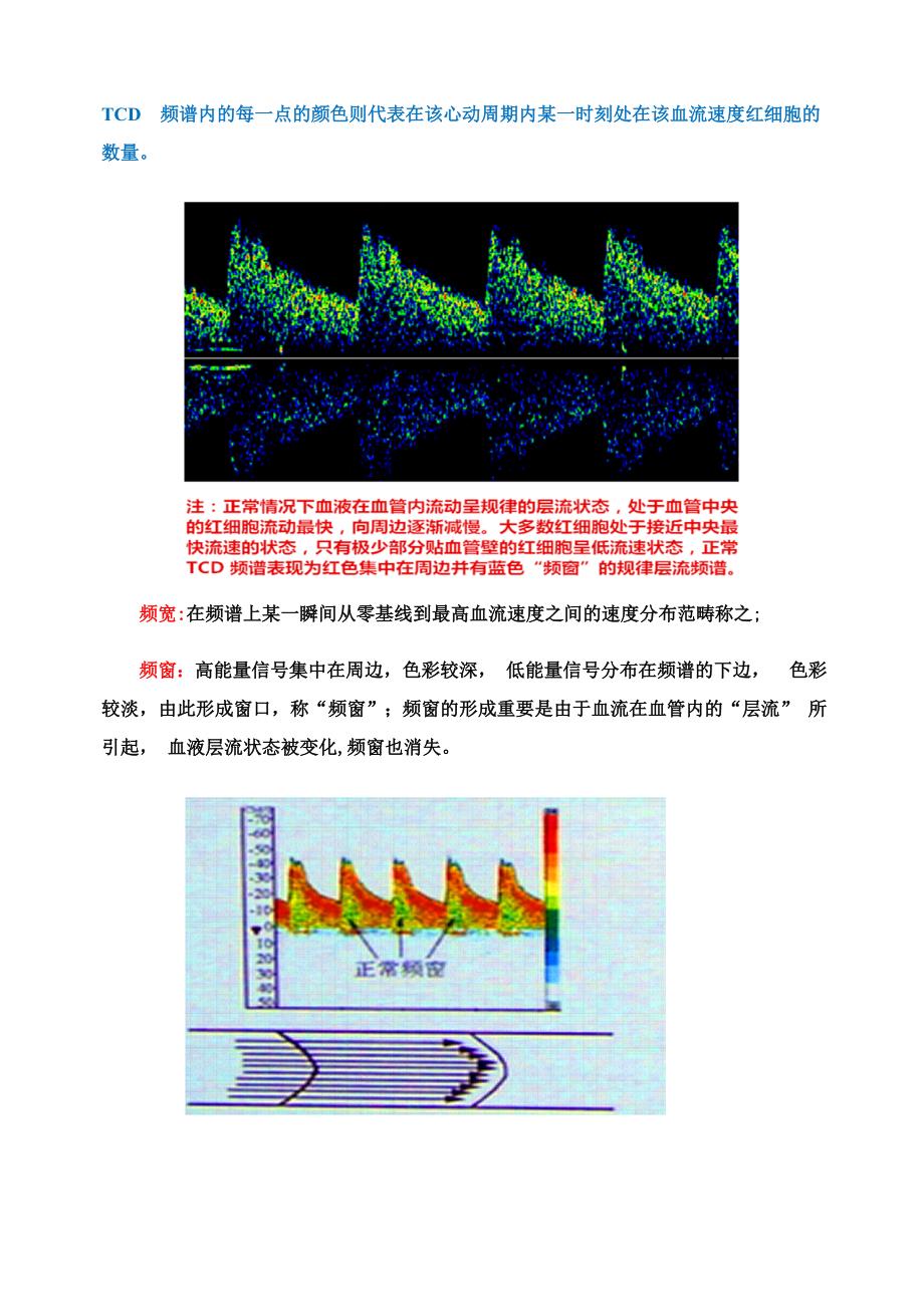 TCD相关知识详细讲解及其在颅脑相关疾病中的应用_第4页