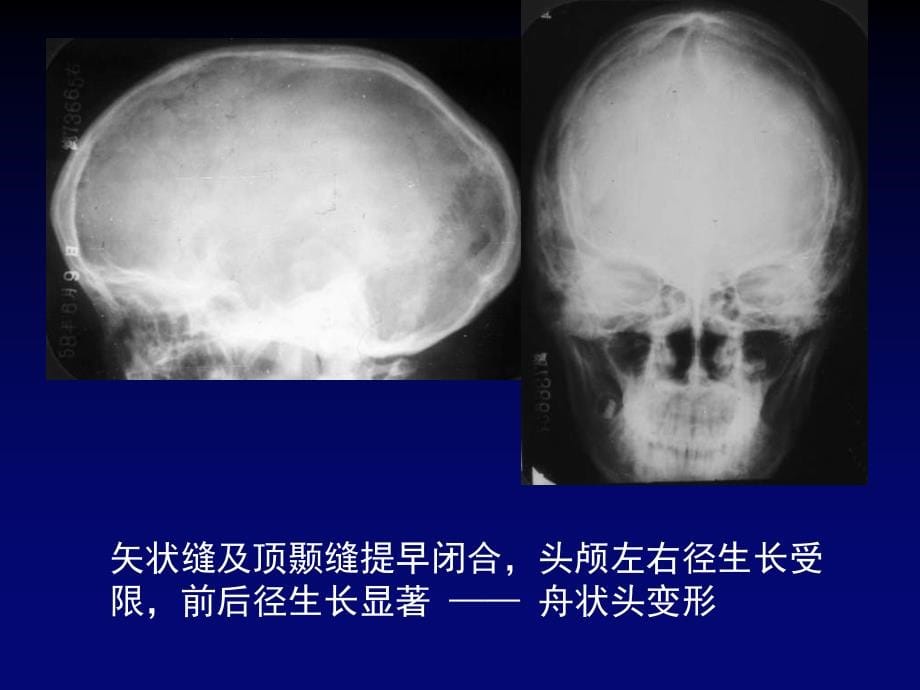 脑先天畸形影像系NX_第5页