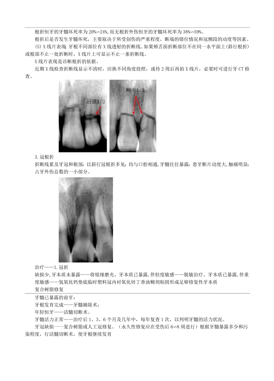 口腔医学-牙急性损伤讲义及练习_第3页