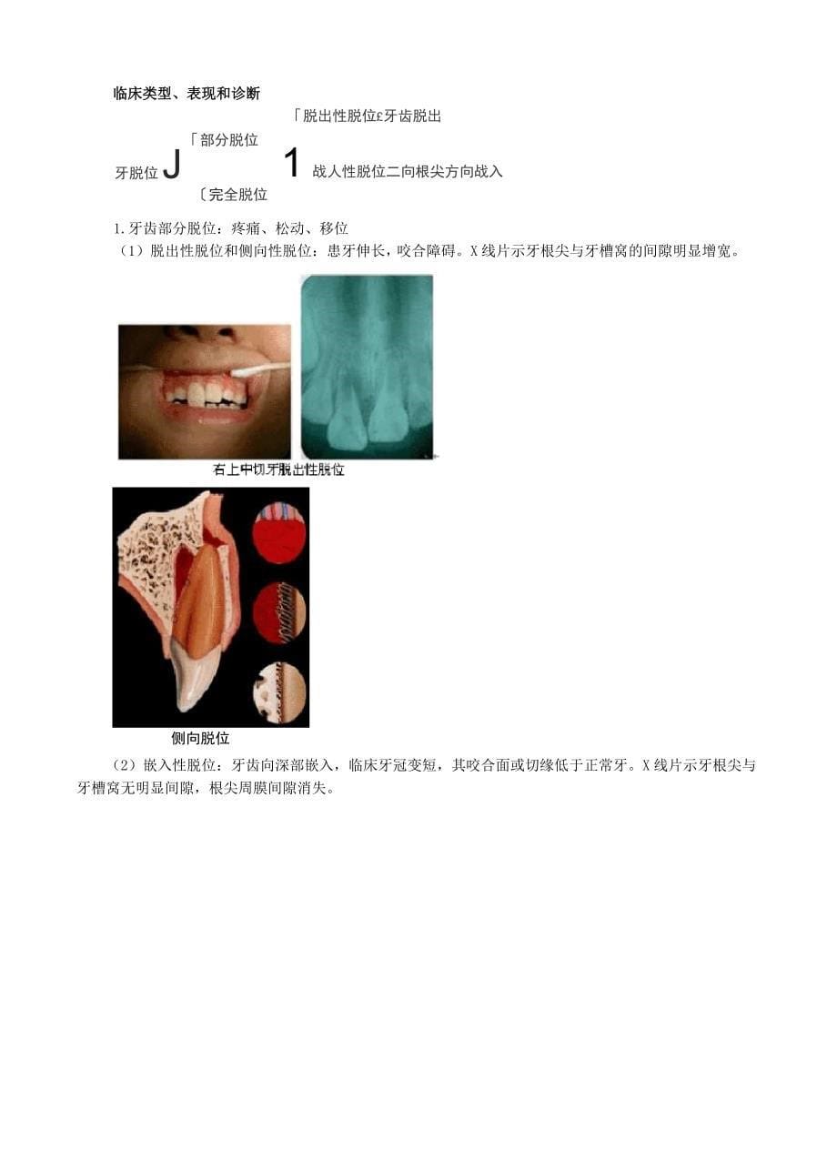 口腔医学-牙急性损伤讲义及练习_第5页