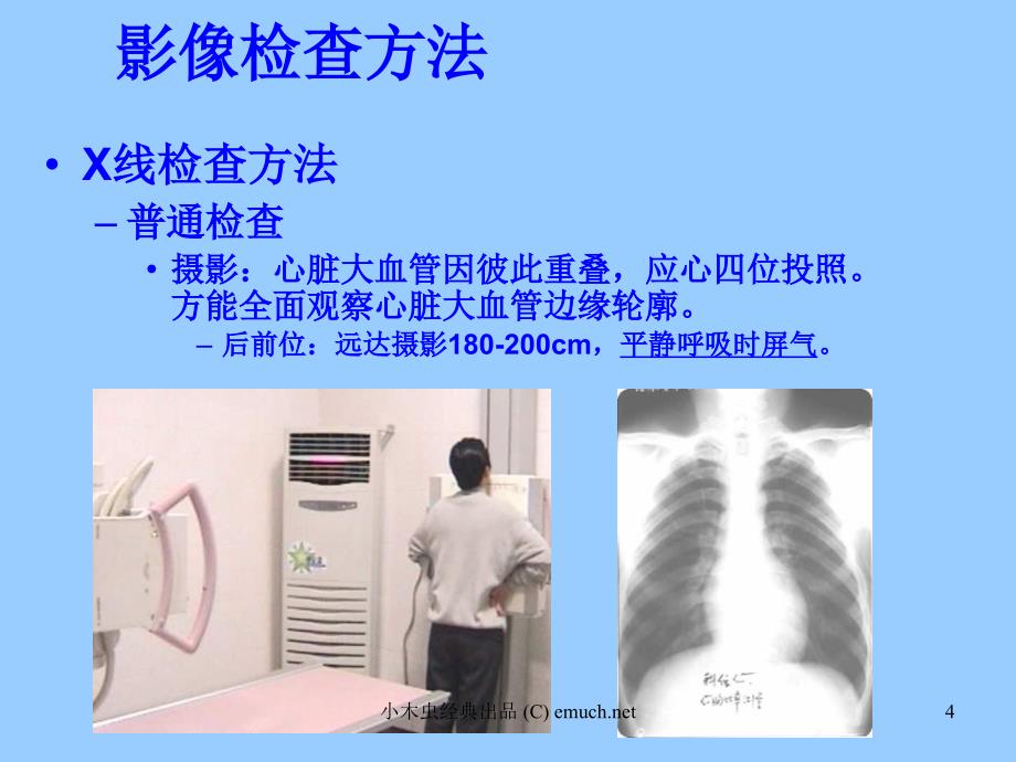 优质医学心与大血管读片方法及常见病的X线诊断_第4页