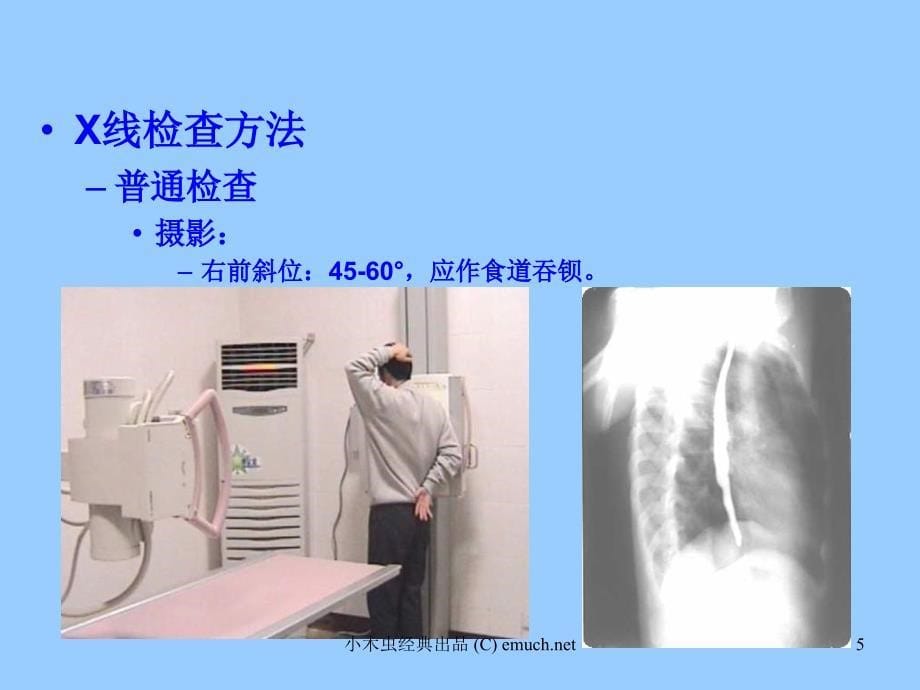 优质医学心与大血管读片方法及常见病的X线诊断_第5页