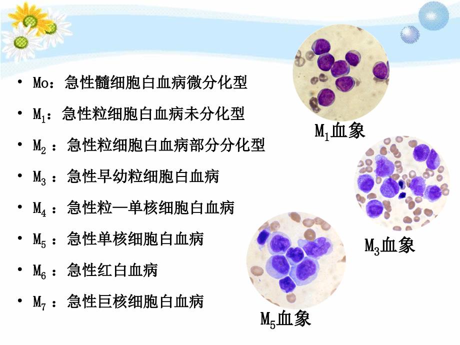 急性白血病护理查房修改文档资料_第4页