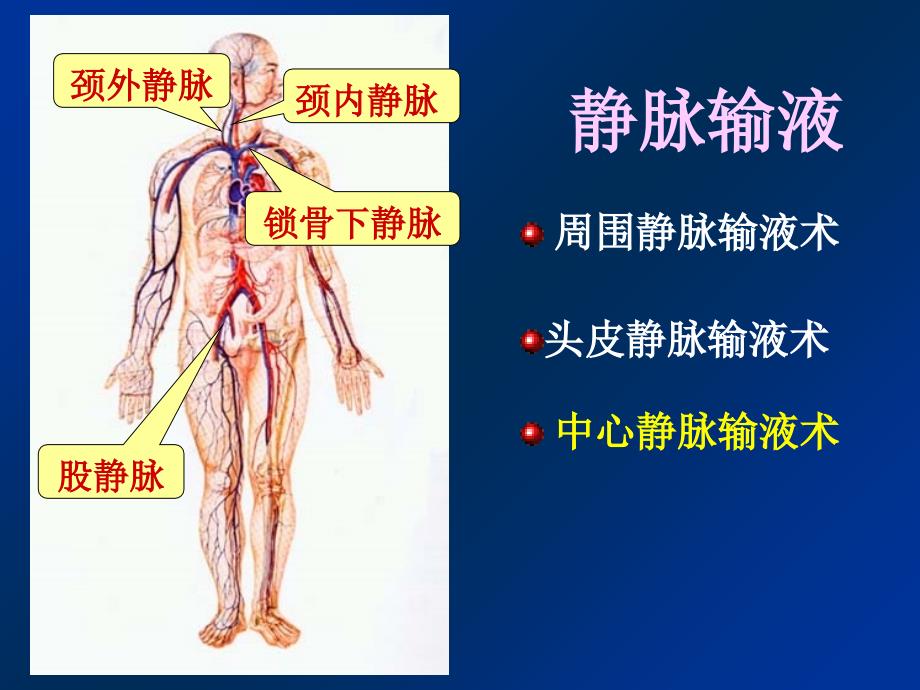 深静脉输液讲义PPT课件_第2页